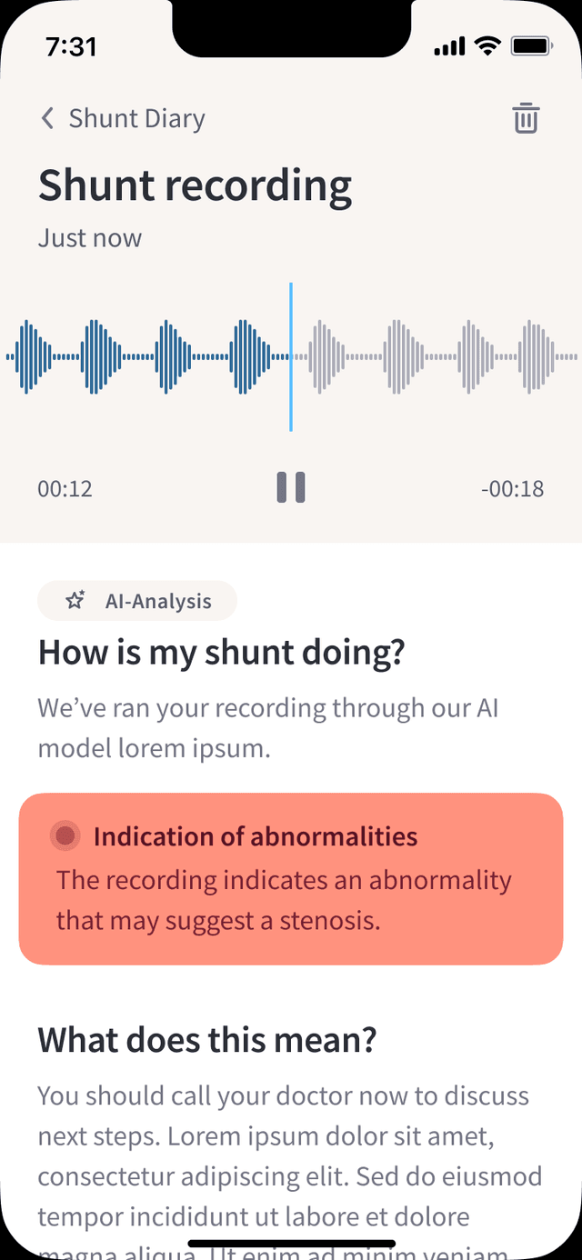 ShuntWizard app — Result detail showing abnormality detected status